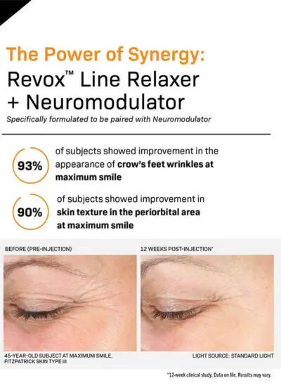Revision-Revox-Line-Relaxer-results with botox
