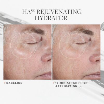 SkinMedica HA5 Rejuvenating Hydrator Before and After