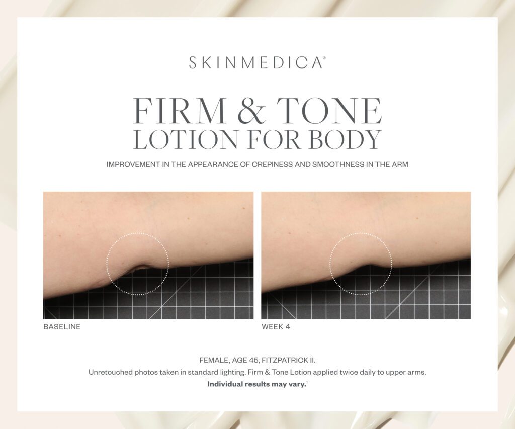 SkinMedica Firm & Tone Before and After 1