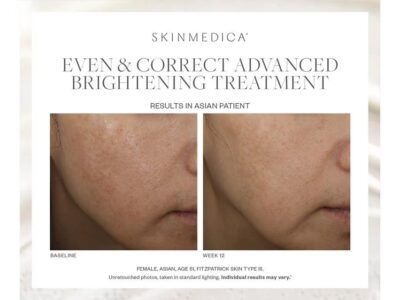Skin Medica Even & Correct Treatment Before & After Photos