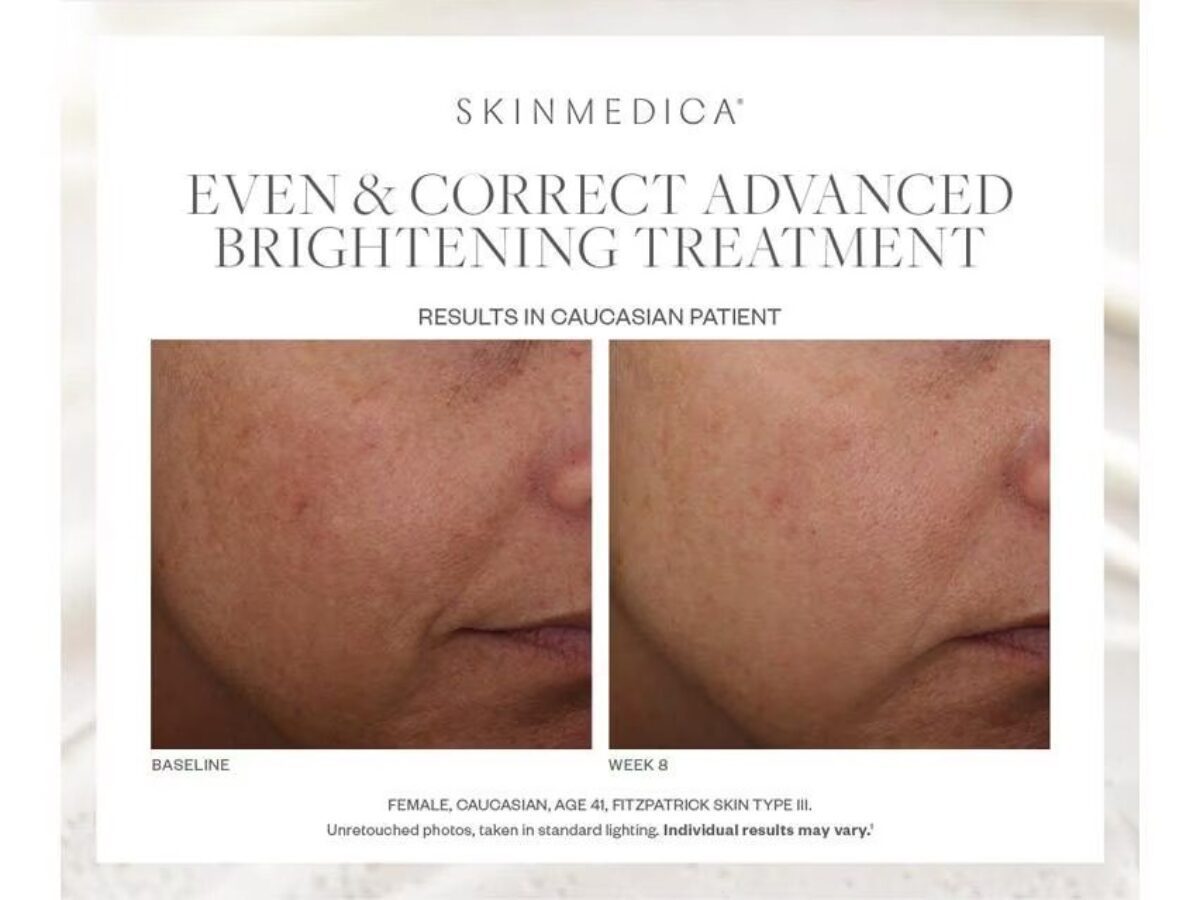 SkinMedica Even & Correct Treatment On Sale! Order Now.