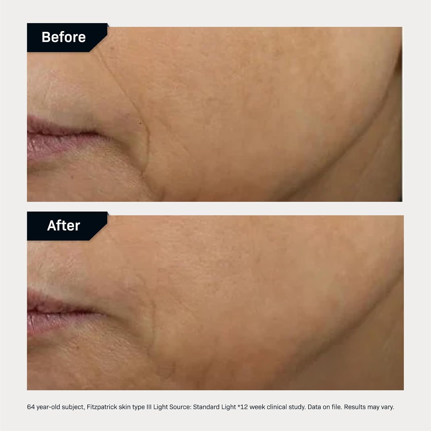 Revision DEJ Face Cream Before and After