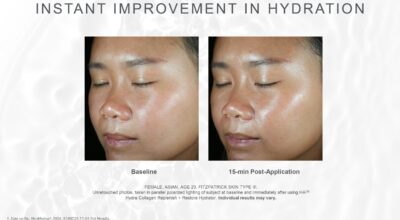 skinmedica ha5 replenish restore hydrator before after instant results