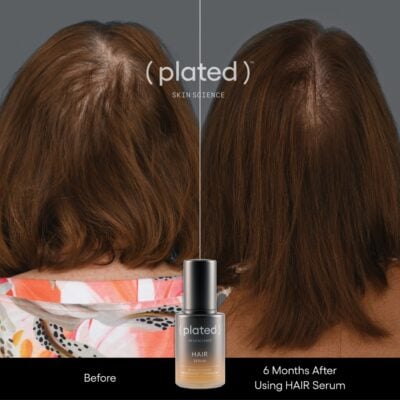 Plated Hair Serum Before and After Female