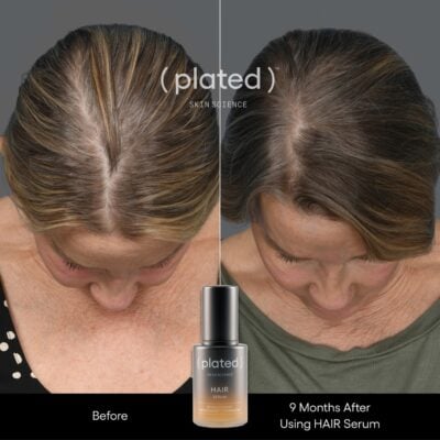 Plated Hair Serum Before and After Female