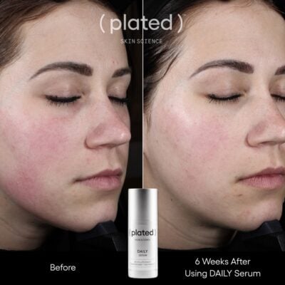 Plated Daily Serum Before and After Female