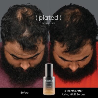 Plated Hair Serum Before and After Male