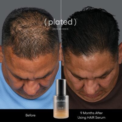 Plated Skin Science Hair Serum Before and After Male