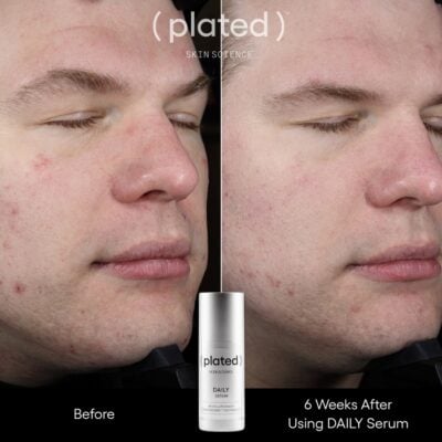 Plated Daily Serum Before and After Male Photo