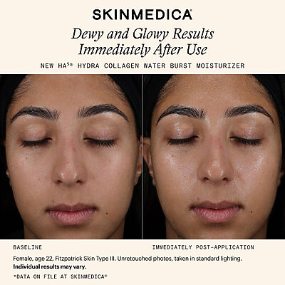 SkinMedica HA5 Hydra Collagen Moisturizer Before After Results