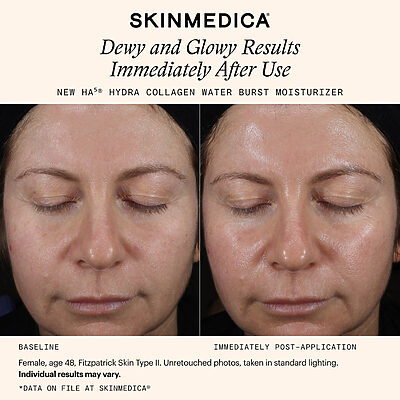 SkinMedica HA5 Hydra Collagen Moisturizer Before and After