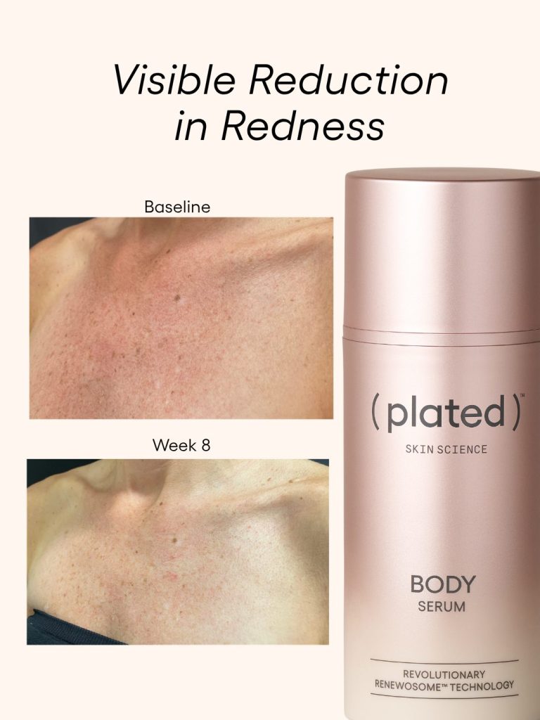 Plated Skin Science BODY Serum before and after